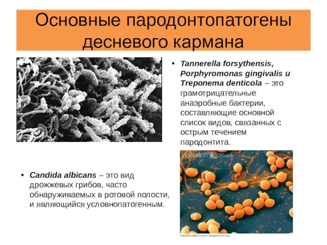 Основные пародонтопатогены десневого кармана Tannerella forsythensis, Porphyromonas gingivalis и Treponema denticola –