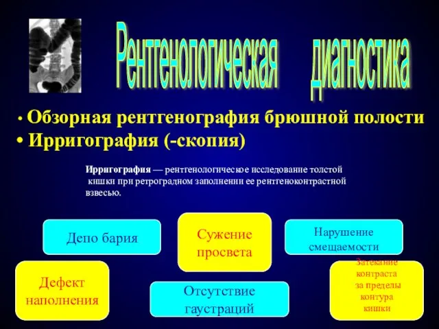 Рентгенологическая диагностика Обзорная рентгенография брюшной полости Ирригография (-скопия) Ирригография — рентгенологическое исследование