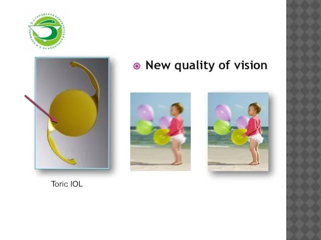 New quality of vision Toric IOL