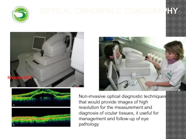 Optical Coherence Tomography Stratus OCT Non-invasive optical diagnostic techniques that would provide