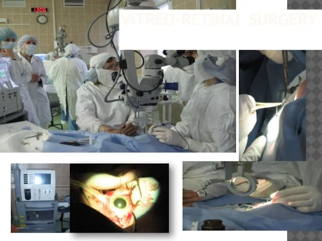 Vitreo-retinal surgery