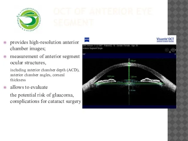 OCT of anterior eye segment provides high-resolution anterior chamber images; measurement of