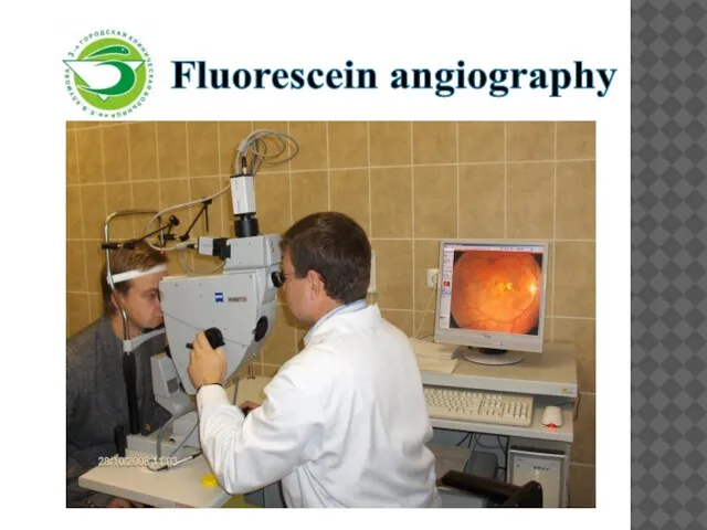 Fluorescein angiography