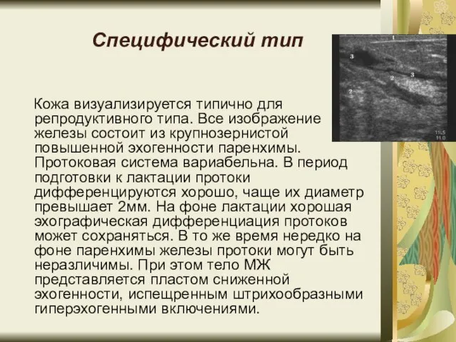 Специфический тип Кожа визуализируется типично для репродуктивного типа. Все изображение железы состоит