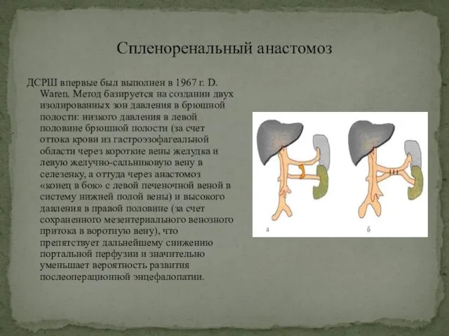 Спленоренальный анастомоз ДСРШ впервые был выполнен в 1967 г. D. Waren. Метод
