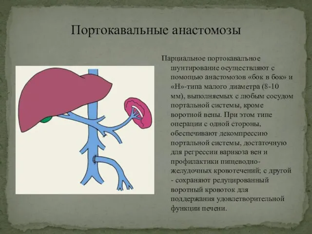 Портокавальные анастомозы Парциальное портокавалъное шунтирование осуществляют с помощью анастомозов «бок в бок»