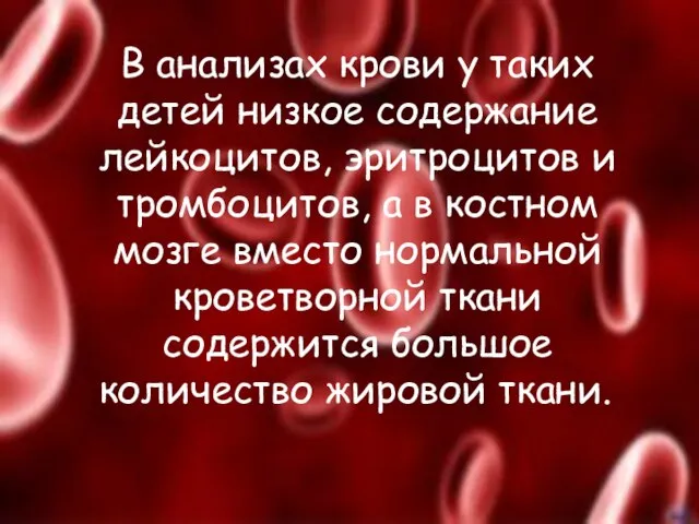 В анализах крови у таких детей низкое содержание лейкоцитов, эритроцитов и тромбоцитов,