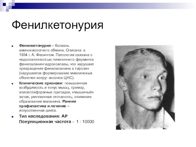 Фенилкетонурия Фенилкетонурия – болезнь аминокислотного обмена. Описана в 1934 г. А. Фелингом.