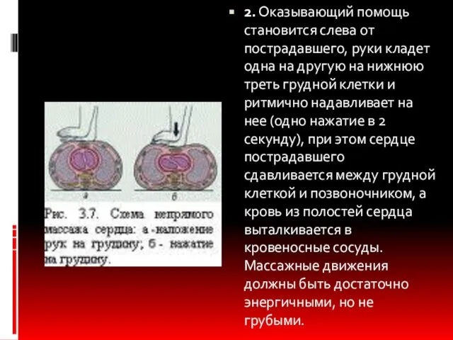 2. Оказывающий помощь становится слева от пострадавшего, руки кладет одна на другую