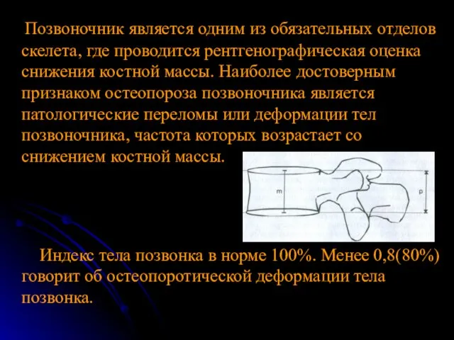 Позвоночник является одним из обязательных отделов скелета, где проводится рентгенографическая оценка снижения