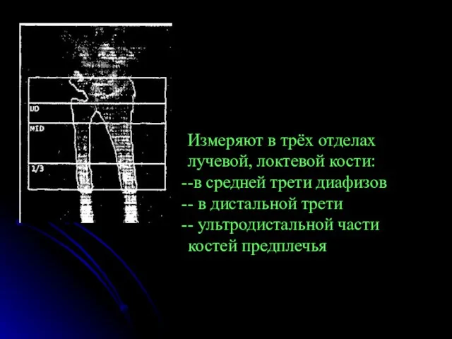 Измеряют в трёх отделах лучевой, локтевой кости: -в средней трети диафизов -