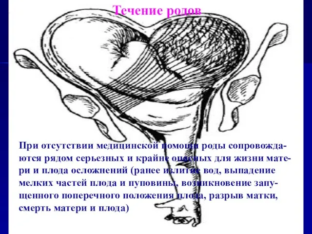 Течение родов При отсутствии медицинской помощи роды сопровожда- ются рядом серьезных и