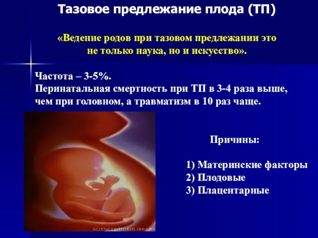 Тазовое предлежание плода (ТП) «Ведение родов при тазовом предлежании это не только