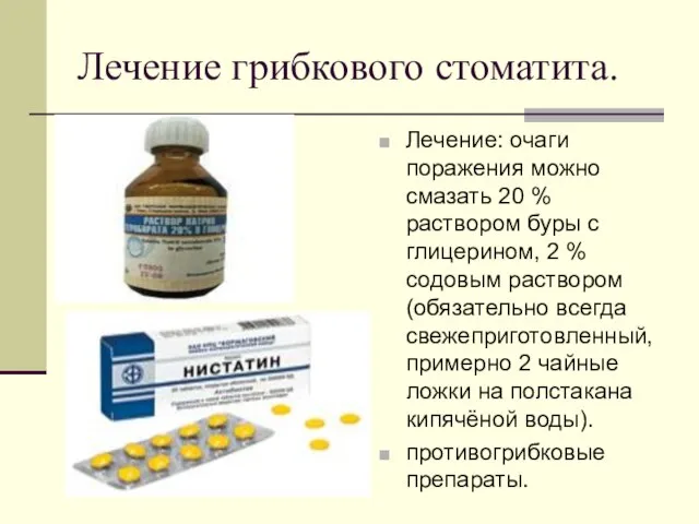 Лечение грибкового стоматита. Лечение: очаги поражения можно смазать 20 % раствором буры