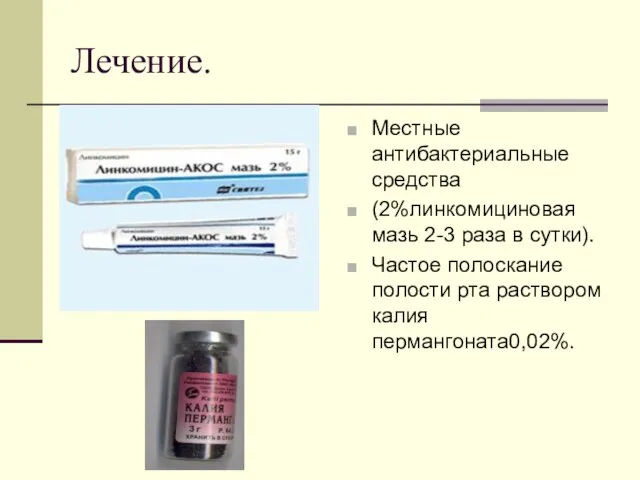 Лечение. Местные антибактериальные средства (2%линкомициновая мазь 2-3 раза в сутки). Частое полоскание