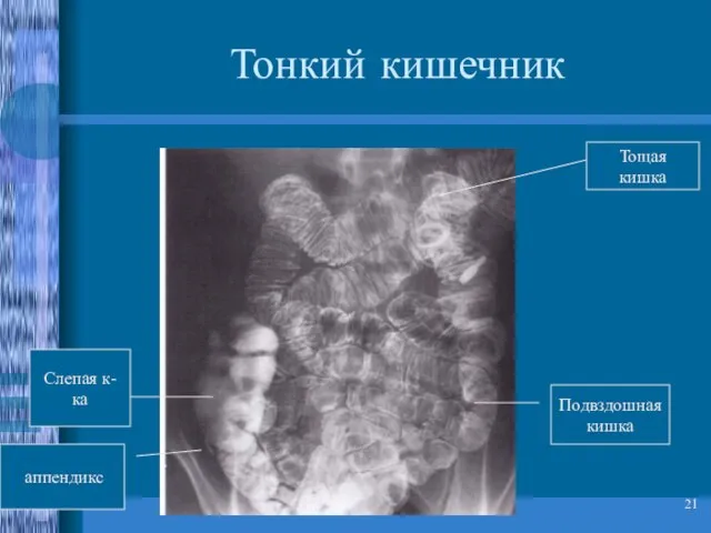 * Тонкий кишечник Тощая кишка Подвздошная кишка Слепая к-ка аппендикс