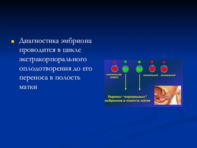 Диагностика эмбриона проводится в цикле экстракорпорального оплодотворения до его переноса в полость матки