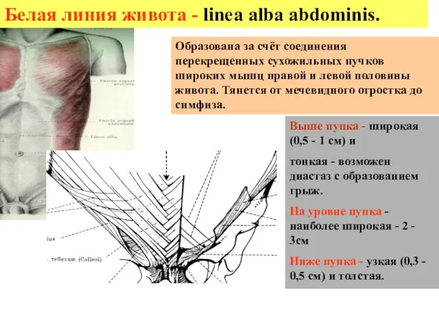 Белая линия живота - linea alba abdominis. Выше пупка - широкая (0,5