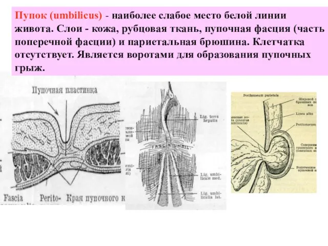 Пупок (umbilicus) - наиболее слабое место белой линии живота. Слои - кожа,