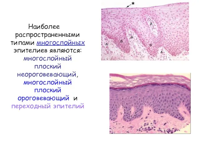 Наиболее распространенными типами многослойных эпителиев являются: многослойный плоский неороговевающий, многослойный плоский ороговевающий и переходный эпителий