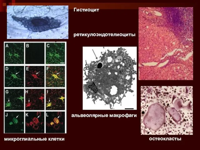 Гистиоцит ретикулоэндотелиоциты альвеолярные макрофаги остеокласты микроглиальные клетки