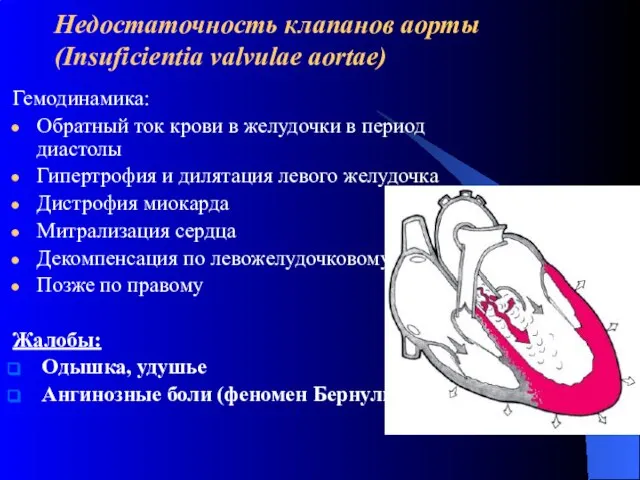 Недостаточность клапанов аорты (Insuficientia valvulae aortae) Гемодинамика: Обратный ток крови в желудочки