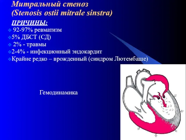 Митральный стеноз (Stenosis ostii mitrale sinstra) ПРИЧИНЫ: 92-97% ревматизм 5% ДБСТ (СД)