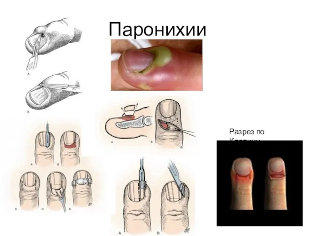 Паронихии Разрез по Кляпину