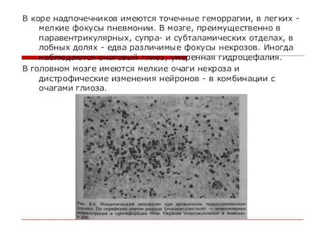 В коре надпочечников имеются точечные геморрагии, в легких - мелкие фокусы пневмонии.