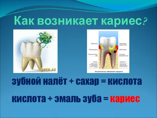 Как возникает кариес? зубной налёт + сахар = кислота кислота + эмаль зуба = кариес