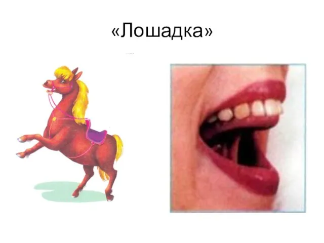 «Лошадка»