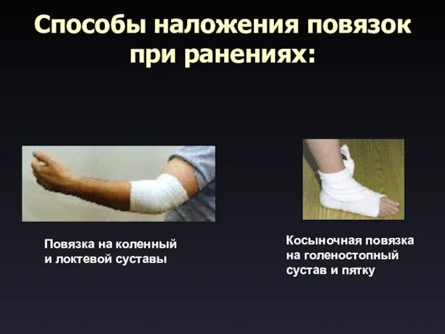 Способы наложения повязок при ранениях: Повязка на коленный и локтевой суставы Косыночная