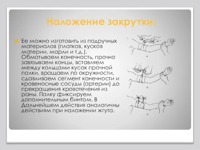 Наложение закрутки: Ее можно изготовить из подручных материалов (платков, кусков материи, марли