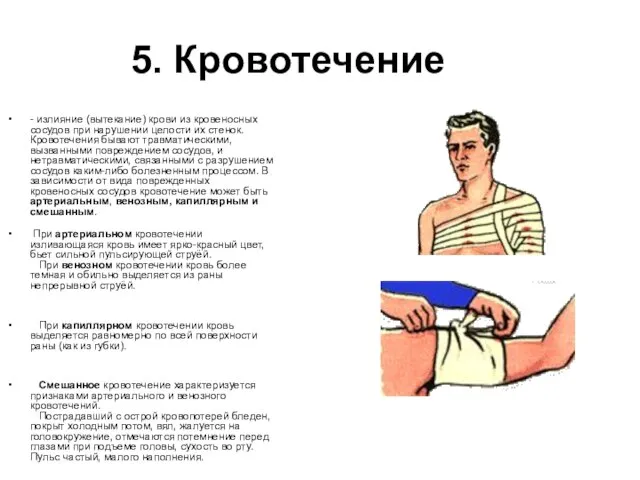 5. Кровотечение - излияние (вытекание) крови из кровеносных сосудов при нарушении целости