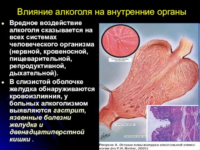 Влияние алкоголя на внутренние органы Вредное воздействие алкоголя сказывается на всех системах