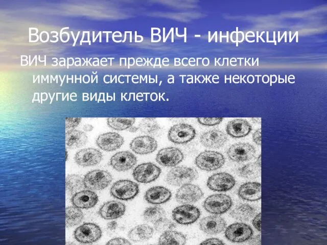 Возбудитель ВИЧ - инфекции ВИЧ заражает прежде всего клетки иммунной системы, а