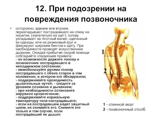 12. При подозрении на повреждения позвоночника осторожно, вдвоем или втроем, перекладывают пострадавшего