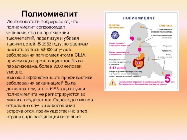 Полиомиелит Исследователи подозревают, что полиомиелит сопровождал человечество на протяжении тысячелетий, парализуя и