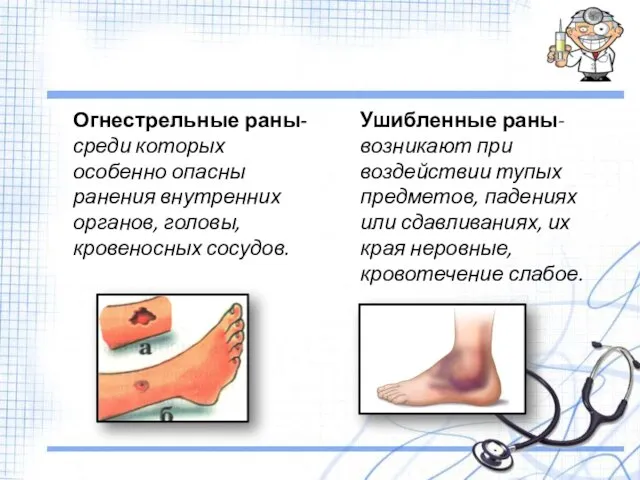 Ушибленные раны-возникают при воздействии тупых предметов, падениях или сдавливаниях, их края неровные,