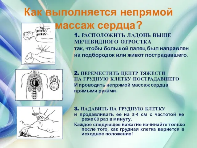 Как выполняется непрямой массаж сердца? 3. НАДАВИТЬ НА ГРУДНУЮ КЛЕТКУ и продавливать