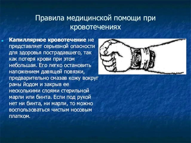 Правила медицинской помощи при кровотечениях Капиллярное кровотечение не представляет серьезной опасности для