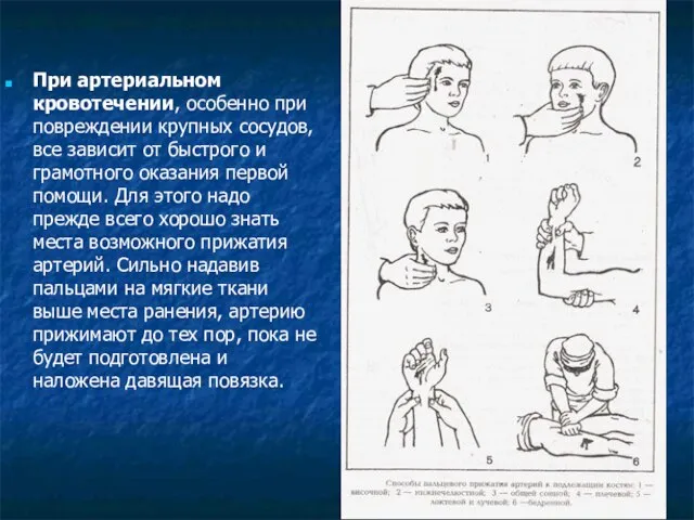 При артериальном кровотечении, особенно при повреждении крупных сосудов, все зависит от быстрого