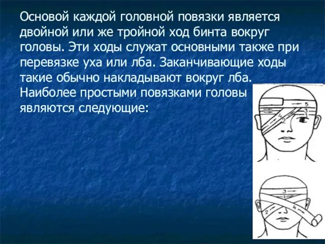 Основой каждой головной повязки является двойной или же тройной ход бинта вокруг