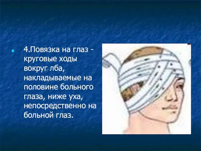 4.Повязка на глаз - круговые ходы вокруг лба, накладываемые на половине больного