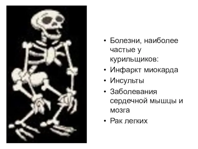 Болезни, наиболее частые у курильщиков: Инфаркт миокарда Инсульты Заболевания сердечной мышцы и мозга Рак легких