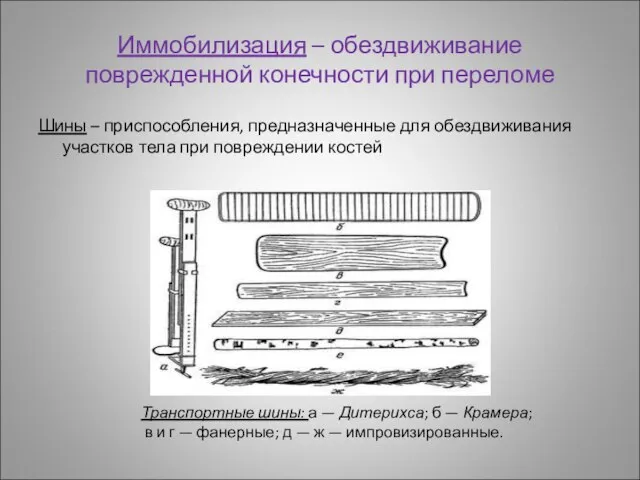 Иммобилизация – обездвиживание поврежденной конечности при переломе Шины – приспособления, предназначенные для