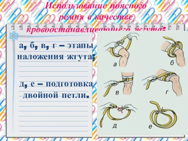 Использование поясного ремня в качестве кровоостанавливающего жгута: а, б, в, г –