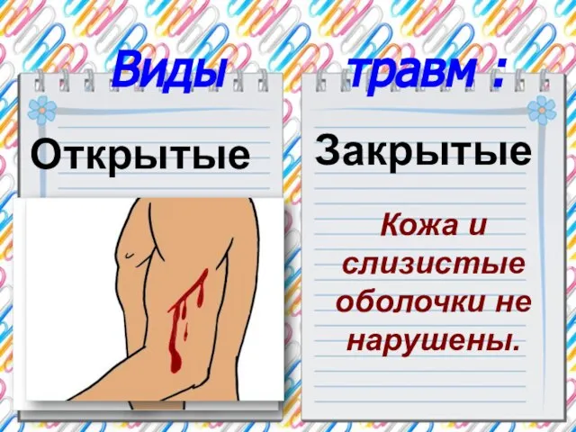 Виды травм : Открытые Вызывают кровотечения. Закрытые Кожа и слизистые оболочки не нарушены.