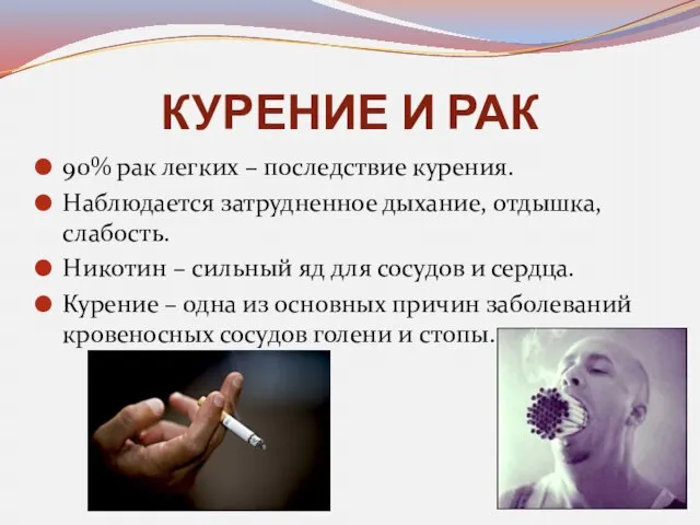 КУРЕНИЕ И РАК 90% рак легких – последствие курения. Наблюдается затрудненное дыхание,