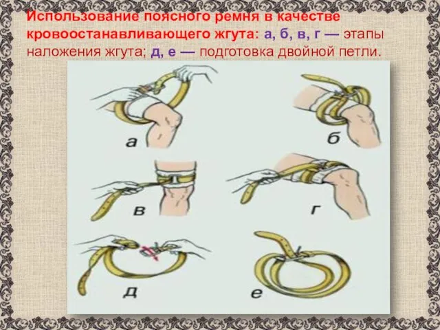 Использование поясного ремня в качестве кровоостанавливающего жгута: а, б, в, г —